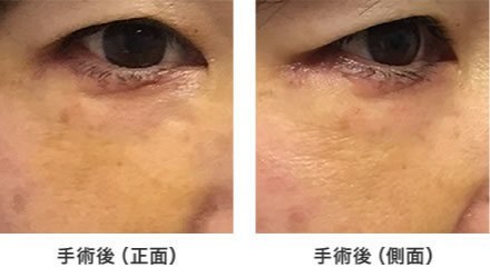 まぶたの外来 おうえんポリクリニック まぶたの外来 おうえんポリクリニック