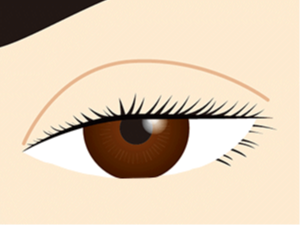 画像：眼瞼下垂症（先天性眼瞼下垂/後天性眼瞼下垂）